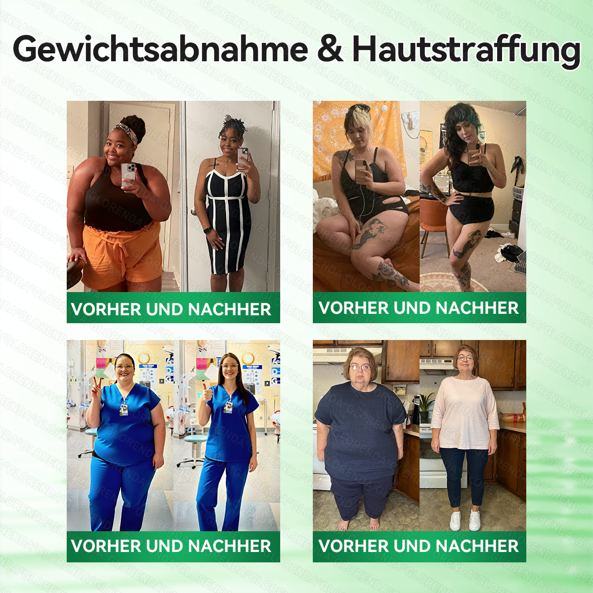 🇩🇪𝐎𝐟𝐟𝐢𝐳𝐢𝐞𝐥𝐥𝐞𝐫 𝐒𝐡𝐨𝐩 | 🔬🔬 𝑮𝑳𝑶𝐑𝐄𝐍𝐃𝘼®𝙈𝙤𝙧𝙞𝙣𝗴𝗮 · 𝗕𝗲𝗿𝗯𝗲𝗿𝒊𝒏 × 𝑵𝘼𝘿+ 10-𝙞𝙣-𝟏 𝐀𝐝𝐯𝐚𝗻𝗰𝗲𝗱 𝗡𝗮𝙣𝙤 𝙈𝙞𝙠𝙧𝐨𝐧𝐚𝐝𝐞𝐥-𝐏𝐚𝒕𝒄𝗵(𝐍𝐮𝐫 𝐞𝐢𝐧𝐦𝐚𝐥 𝐭ä𝐠𝐥𝐢𝐜𝐡, 𝐬𝐢𝐜𝐡𝐭𝐛𝐚𝐫𝐞 𝐕𝐞𝐫ä𝐧𝐝𝐞𝐫𝐮𝐧𝐠𝐞𝐧 𝐢𝐧 𝟕 𝐓𝐚𝐠𝐞𝐧)✅ 𝐅ü𝐫 𝐅𝐞𝐭𝐭𝐥𝐞𝐢𝐛𝐢𝐠𝐤𝐞𝐢𝐭, 𝐇𝐚𝐮𝐭𝐬𝐭𝐫𝐚𝐟𝐟𝐮𝐧𝐠, 𝐃𝐢𝐚𝐛𝐞𝐭𝐞𝐬, 𝐒𝐜𝐡𝐥𝐚𝐟𝐚𝐩𝐧𝐨𝐞, 𝐆𝐞𝐥𝐞𝐧𝐤𝐩𝐫𝐨𝐛𝐥𝐞𝐦𝐞 𝐮𝐧𝐝 𝐦𝐞𝐡𝐫!
