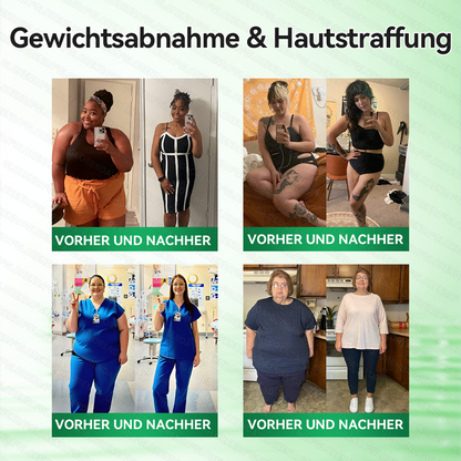 🇩🇪𝐎𝐟𝐟𝐢𝐳𝐢𝐞𝐥𝐥𝐞𝐫 𝐒𝐡𝐨𝐩 | 🔬🔬 𝑮𝑳𝑶𝐑𝐄𝐍𝐃𝘼®𝙈𝙤𝙧𝙞𝙣𝗴𝗮 · 𝗕𝗲𝗿𝗯𝗲𝗿𝒊𝒏 × 𝑵𝘼𝘿+ 10-𝙞𝙣-𝟏 𝐀𝐝𝐯𝐚𝗻𝗰𝗲𝗱 𝗡𝗮𝙣𝙤 𝙈𝙞𝙠𝙧𝐨𝐧𝐚𝐝𝐞𝐥-𝐏𝐚𝒕𝒄𝗵(𝐍𝐮𝐫 𝐞𝐢𝐧𝐦𝐚𝐥 𝐭ä𝐠𝐥𝐢𝐜𝐡, 𝐬𝐢𝐜𝐡𝐭𝐛𝐚𝐫𝐞 𝐕𝐞𝐫ä𝐧𝐝𝐞𝐫𝐮𝐧𝐠𝐞𝐧 𝐢𝐧 𝟕 𝐓𝐚𝐠𝐞𝐧)✅ 𝐅ü𝐫 𝐅𝐞𝐭𝐭𝐥𝐞𝐢𝐛𝐢𝐠𝐤𝐞𝐢𝐭, 𝐇𝐚𝐮𝐭𝐬𝐭𝐫𝐚𝐟𝐟𝐮𝐧𝐠, 𝐃𝐢𝐚𝐛𝐞𝐭𝐞𝐬, 𝐒𝐜𝐡𝐥𝐚𝐟𝐚𝐩𝐧𝐨𝐞, 𝐆𝐞𝐥𝐞𝐧𝐤𝐩𝐫𝐨𝐛𝐥𝐞𝐦𝐞 𝐮𝐧𝐝 𝐦𝐞𝐡𝐫!