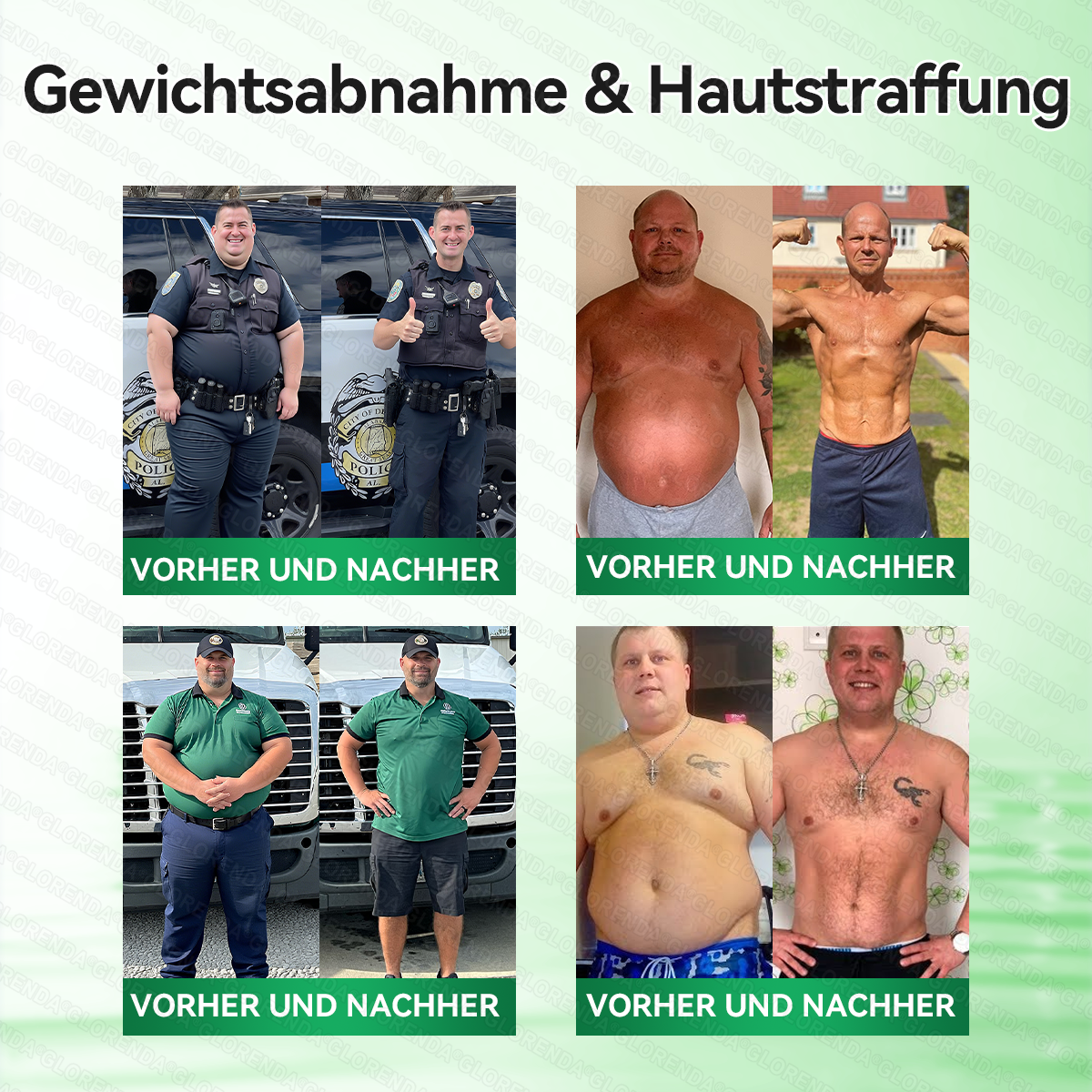 🇩🇪𝐎𝐟𝐟𝐢𝐳𝐢𝐞𝐥𝐥𝐞𝐫 𝐒𝐡𝐨𝐩 | 🔬🔬 𝑮𝑳𝑶𝐑𝐄𝐍𝐃𝘼®𝙈𝙤𝙧𝙞𝙣𝗴𝗮 · 𝗕𝗲𝗿𝗯𝗲𝗿𝒊𝒏 × 𝑵𝘼𝘿+ 10-𝙞𝙣-𝟏 𝐀𝐝𝐯𝐚𝗻𝗰𝗲𝗱 𝗡𝗮𝙣𝙤 𝙈𝙞𝙠𝙧𝐨𝐧𝐚𝐝𝐞𝐥-𝐏𝐚𝒕𝒄𝗵(𝐍𝐮𝐫 𝐞𝐢𝐧𝐦𝐚𝐥 𝐭ä𝐠𝐥𝐢𝐜𝐡, 𝐬𝐢𝐜𝐡𝐭𝐛𝐚𝐫𝐞 𝐕𝐞𝐫ä𝐧𝐝𝐞𝐫𝐮𝐧𝐠𝐞𝐧 𝐢𝐧 𝟕 𝐓𝐚𝐠𝐞𝐧)✅ 𝐅ü𝐫 𝐅𝐞𝐭𝐭𝐥𝐞𝐢𝐛𝐢𝐠𝐤𝐞𝐢𝐭, 𝐇𝐚𝐮𝐭𝐬𝐭𝐫𝐚𝐟𝐟𝐮𝐧𝐠, 𝐃𝐢𝐚𝐛𝐞𝐭𝐞𝐬, 𝐒𝐜𝐡𝐥𝐚𝐟𝐚𝐩𝐧𝐨𝐞, 𝐆𝐞𝐥𝐞𝐧𝐤𝐩𝐫𝐨𝐛𝐥𝐞𝐦𝐞 𝐮𝐧𝐝 𝐦𝐞𝐡𝐫!