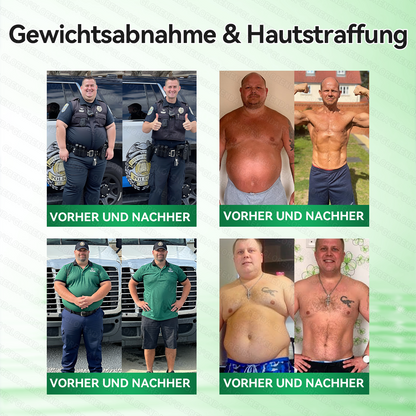 🇩🇪𝐎𝐟𝐟𝐢𝐳𝐢𝐞𝐥𝐥𝐞𝐫 𝐒𝐡𝐨𝐩 | 🔬🔬 𝑮𝑳𝑶𝐑𝐄𝐍𝐃𝘼®𝙈𝙤𝙧𝙞𝙣𝗴𝗮 · 𝗕𝗲𝗿𝗯𝗲𝗿𝒊𝒏 × 𝑵𝘼𝘿+ 10-𝙞𝙣-𝟏 𝐀𝐝𝐯𝐚𝗻𝗰𝗲𝗱 𝗡𝗮𝙣𝙤 𝙈𝙞𝙠𝙧𝐨𝐧𝐚𝐝𝐞𝐥-𝐏𝐚𝒕𝒄𝗵(𝐍𝐮𝐫 𝐞𝐢𝐧𝐦𝐚𝐥 𝐭ä𝐠𝐥𝐢𝐜𝐡, 𝐬𝐢𝐜𝐡𝐭𝐛𝐚𝐫𝐞 𝐕𝐞𝐫ä𝐧𝐝𝐞𝐫𝐮𝐧𝐠𝐞𝐧 𝐢𝐧 𝟕 𝐓𝐚𝐠𝐞𝐧)✅ 𝐅ü𝐫 𝐅𝐞𝐭𝐭𝐥𝐞𝐢𝐛𝐢𝐠𝐤𝐞𝐢𝐭, 𝐇𝐚𝐮𝐭𝐬𝐭𝐫𝐚𝐟𝐟𝐮𝐧𝐠, 𝐃𝐢𝐚𝐛𝐞𝐭𝐞𝐬, 𝐒𝐜𝐡𝐥𝐚𝐟𝐚𝐩𝐧𝐨𝐞, 𝐆𝐞𝐥𝐞𝐧𝐤𝐩𝐫𝐨𝐛𝐥𝐞𝐦𝐞 𝐮𝐧𝐝 𝐦𝐞𝐡𝐫!